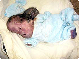 /x/images2005/baby_three_heads.jpg