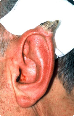 ear_horn.jpg