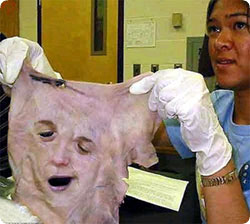 face_transplant_french3.jpg