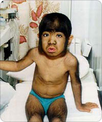 hairy_child3.jpg