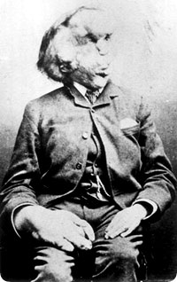 john_merrick2.jpg