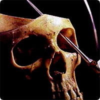 /x/images2005/lobotomy1.jpg