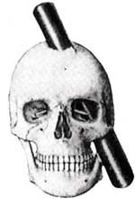 lobotomy5.jpg