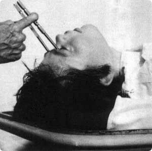 lobotomy6.jpg