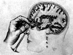 lobotomy8.jpg