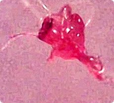 /x/images2005/morgellons.jpg
