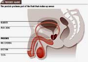 prostate.jpg