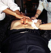 psychic_surgery3.jpg